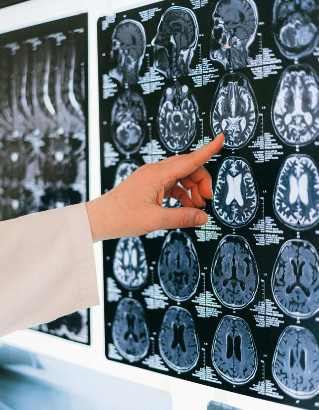 fundación ataxias y otras neurodegenerativas. Tucuman